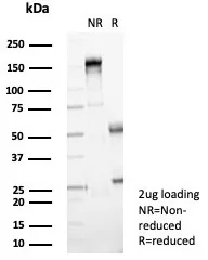 SDS-PAGE Analysis of Purified NME2 / nm23-H2 Mouse Monoclonal Antibody (NME2/4160). Confirmation of Purity and Integrity of Antibody.