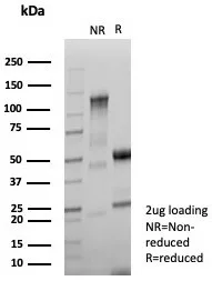 NME2 Antibody in SDS-PAGE