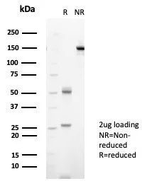 SDS-PAGE Analysis of Purified NME2 / nm23-H2 Mouse Monoclonal Antibody (NME2/6434). Confirmation of Purity and Integrity of Antibody.