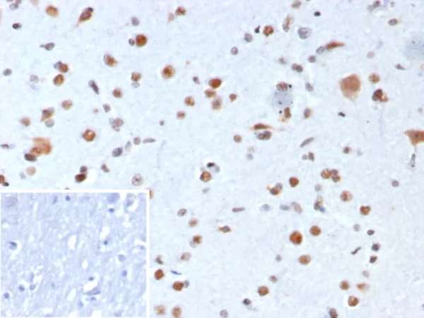 Formalin-fixed, paraffin-embedded human brain stained with  Nucleophosmin Recombinant Mouse Monoclonal Antibody (rNPM1/8056). Inset: PBS instead of primary antibody; secondary only negative control.