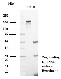 SDS-PAGE Analysis of Purified CD73 Mouse Monoclonal Antibody (NT5E/4679). Confirmation of Purity and Integrity of Antibody.