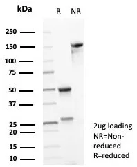 SDS-PAGE Analysis of Purified NTRK2 / TRKb Mouse Monoclonal Antibody (NTRK2/4672). Confirmation of Purity and Integrity of Antibody.