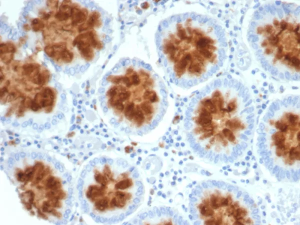 Formalin-fixed, paraffin-embedded human colon stained with NTRK2 / TRKb Mouse Monoclonal Antibody (NTRK2/4672). HIER: Tris/EDTA, pH9.0, 45min. 2°C: HRP-polymer, 30min. DAB, 5min.