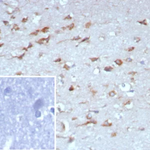 Formalin-fixed, paraffin-embedded human brain stained with NTRK2 / TRKb Mouse Monoclonal Antibody (NTRK2/7926). Inset: PBS instead of primary antibody; secondary only negative control.