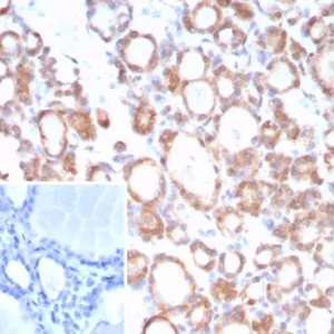 Formalin-fixed, paraffin-embedded human thyroid stained with NTRK2 / TRKb Mouse Monoclonal Antibody (NTRK2/7929). Inset: PBS instead of primary antibody; secondary only negative control.