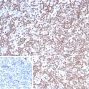 Formalin-fixed, paraffin-embedded human tonsil stained with SMARCAL1 Mouse Monoclonal Antibody (PCRP-SMARCAL1-1C4). Inset: PBS instead of primary antibody; secondary only negative control.