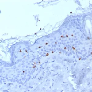 Formalin-fixed, paraffin-embedded human skin stained with Langerin Mouse Monoclonal Antibody (LGRN/7430). HIER: Tris/EDTA, pH9.0, 45min. 2°C: HRP-polymer, 30min. DAB, 5min.