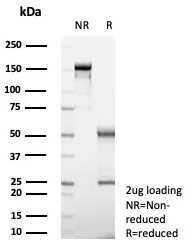 SDS-PAGE Analysis of Purified Langerin Mouse Monoclonal Antibody (LGRN/7541). Confirmation of Purity and Integrity of Antibody.