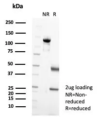 SDS-PAGE Analysis of Purified Langerin Mouse Monoclonal Antibody (LGRN/7356). Confirmation of Purity and Integrity of Antibody.