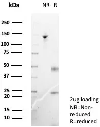 SDS-PAGE Analysis of Purified Langerin Mouse Monoclonal Antibody (LGRN/7357). Confirmation of Purity and Integrity of Antibody.