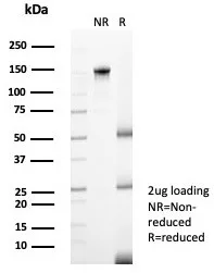 SDS-PAGE Analysis of Purified Langerin Mouse Monoclonal Antibody (LGRN/7428). Confirmation of Purity and Integrity of Antibody.