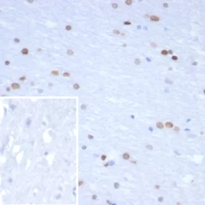 Formalin-fixed, paraffin-embedded human brain stained with NEUROG3 Mouse Monoclonal Antibody (NGN3/1809) Inset: PBS instead of primary antibody; secondary only negative control.
