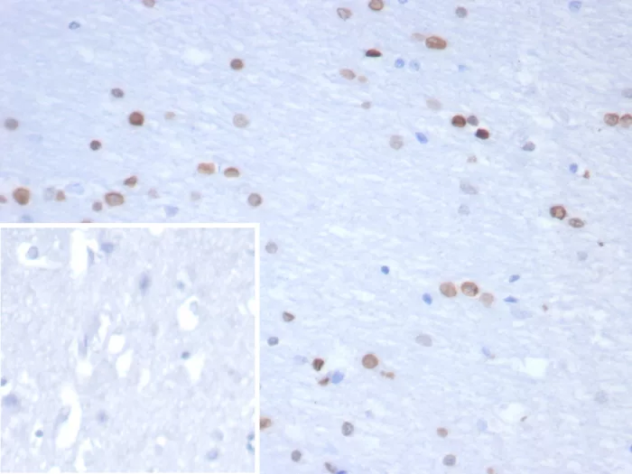 Formalin-fixed, paraffin-embedded human brain stained with NEUROG3 Mouse Monoclonal Antibody (NGN3/1809) Inset: PBS instead of primary antibody; secondary only negative control. NEUROG3 / Neurogenin 3 / NGN3 (Transcription Factor) Antibody