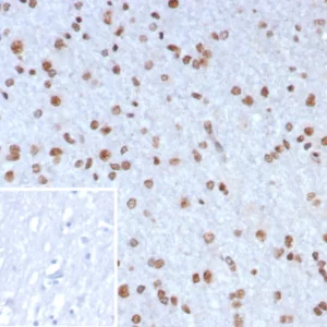 Formalin-fixed, paraffin-embedded human brain stained with NEUROG3 Mouse Monoclonal Antibody (NGN3/7698). Inset: PBS instead of primary antibody; secondary only negative control.