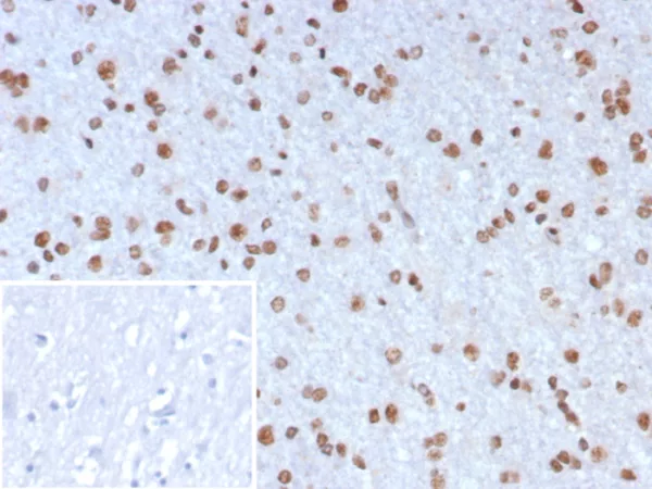 Formalin-fixed, paraffin-embedded human brain stained with NEUROG3 Mouse Monoclonal Antibody (NGN3/7698). Inset: PBS instead of primary antibody; secondary only negative control.