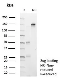 SDS-PAGE Analysis of Purified NEUROG3 Mouse Monoclonal Antibody (NGN3/7698). Confirmation of Purity and Integrity of Antibody.