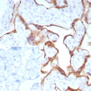 Formalin-fixed, paraffin-embedded human placenta stained with PAPP-A Recombinant Rabbit Monoclonal Antibody (PAPPA/8804R). HIER: Tris/EDTA, pH9.0, 45min. 2°C: HRP-polymer, 30min. DAB, 5min.