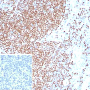 Formalin-fixed, paraffin-embedded human tonsil stained with PAX3 Mouse Monoclonal Antibody (PAX3/8426). Inset: PBS instead of primary antibody; secondary only negative control.