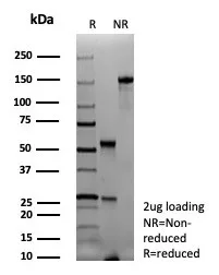 SDS-PAGE Analysis of Purified PAX6 Recombinant Mouse Monoclonal Antibody (rPAX6/9324). Confirmation of Purity and Integrity of Antibody.