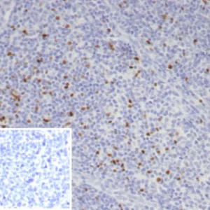 Formalin-fixed, paraffin-embedded human tonsil stained with FOXP3 Recombinant Rabbit Monoclonal Antibody (FOXP3/7990R). Inset: PBS instead of primary antibody; secondary only negative control.