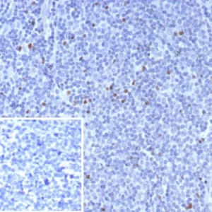 Formalin-fixed, paraffin-embedded human tonsil stained with FOXP3 Recombinant Rabbit Monoclonal Antibody (FOXP3/8015R). Inset: PBS instead of primary antibody; secondary only negative control.