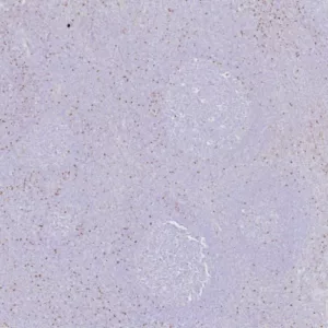 Formalin-fixed, paraffin-embedded human tonsil stained with FOXP3 Recombinant Rabbit Monoclonal Antibody (FOXP3/8145R). HIER: Tris/EDTA, pH9.0, 45min. 2°C: HRP-polymer, 30min. DAB, 5min.