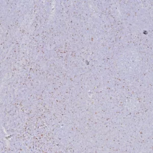 Formalin-fixed, paraffin-embedded human tonsil stained with FOXP3 Recombinant Rabbit Monoclonal Antibody (FOXP3/8277R). HIER: Tris/EDTA, pH9.0, 45min. 2°C: HRP-polymer, 30min. DAB, 5min.