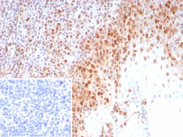 Formalin-fixed, paraffin-embedded human tonsil stained with PCNA Recombinant Mouse Monoclonal Antibody (rPCNA/8858) at 2ug/ml. Inset: PBS instead of primary antibody; secondary only negative control.