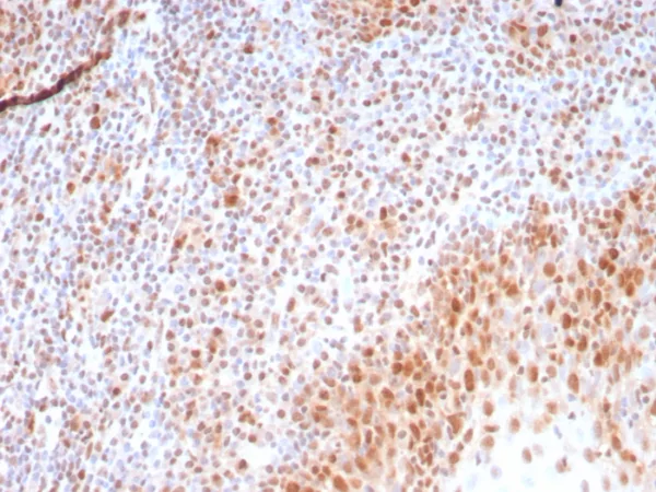Formalin-fixed, paraffin-embedded human tonsil stained with PCNA Recombinant Mouse Monoclonal Antibody (rPCNA/8858) at 2ug/ml. HIER: Tris/EDTA, pH9.0, 45min. 2°C: HRP-polymer, 30min. DAB, 5min.