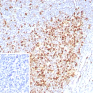 Formalin-fixed, paraffin-embedded human tonsil stained with PCNA Recombinant Mouse Monoclonal Antibody (rPCNA/8859) at 2ug/ml. Inset: PBS instead of primary antibody; secondary only negative control.