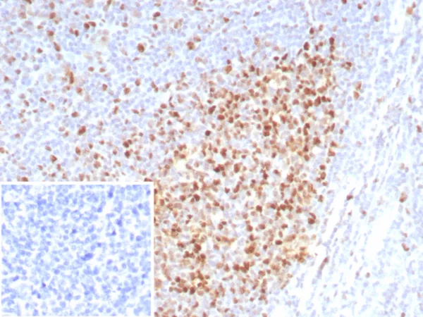 Formalin-fixed, paraffin-embedded human tonsil stained with PCNA Recombinant Mouse Monoclonal Antibody (rPCNA/8859) at 2ug/ml. Inset: PBS instead of primary antibody; secondary only negative control.