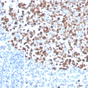 Formalin-fixed, paraffin-embedded human tonsil stained with PCNA Mouse Monoclonal Antibody (PCNA/4540) at 2ug/ml. Inset: PBS instead of primary antibody; secondary only negative control.