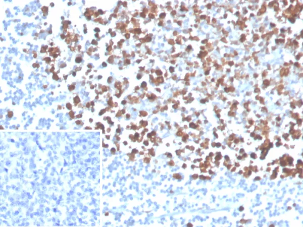 Formalin-fixed, paraffin-embedded human tonsil stained with PCNA Mouse Monoclonal Antibody (PCNA/4540) at 2ug/ml. Inset: PBS instead of primary antibody; secondary only negative control.