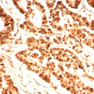 Formalin-fixed, paraffin-embedded human prostate stained with PCNA Recombinant Rabbit Monoclonal Antibody (PCNA/8696R). Inset: PBS instead of primary antibody; secondary only negative control.