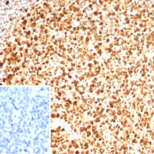 Formalin-fixed, paraffin-embedded human tonsil stained with PCNA Recombinant Rabbit Monoclonal Antibody (PCNA/8633R). Inset: PBS instead of primary antibody; secondary only negative control.