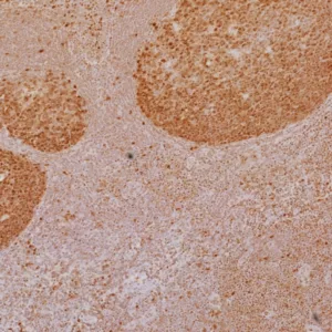 Formalin-fixed, paraffin-embedded human tonsil stained with LEF1 Mouse Monoclonal Antibody (LEF1/6764). HIER: Tris/EDTA, pH9.0, 45min. 2°C: HRP-polymer, 30min. DAB, 5min.