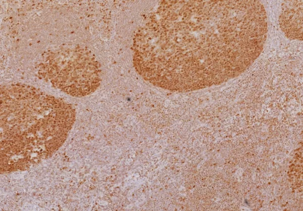 Formalin-fixed, paraffin-embedded human tonsil stained with LEF1 Mouse Monoclonal Antibody (LEF1/6764). HIER: Tris/EDTA, pH9.0, 45min. 2°C: HRP-polymer, 30min. DAB, 5min.