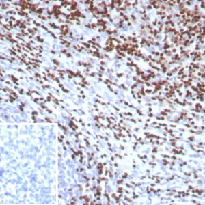 Formalin-fixed, paraffin-embedded human tonsil stained with LEF1 Recombinant Mouse Monoclonal Antibody (rLEF1/8854). Inset: PBS instead of primary. Secondary antibody negative control.