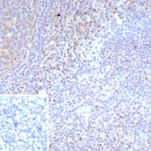 Formalin-fixed, paraffin-embedded analysis of human tonsil.  Strong nuclear staining of non-germinal center cells using LEF1/9403R. Inset: PBS instead of primary antibody; secondary only negative control.