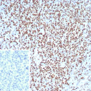 Formalin-fixed, paraffin-embedded analysis of human tonsil.  Strong nuclear staining of non-germinal center cells using LEF1/8629R. Inset: PBS instead of primary antibody; secondary only negative control.
