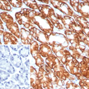 Formalin-fixed, paraffin-embedded human stomach stained with Claudin18.2 Recombinant Rabbit Monoclonal Antibody (CLDN18.2/8141R). Inset: PBS instead of primary antibody; secondary only negative control.
