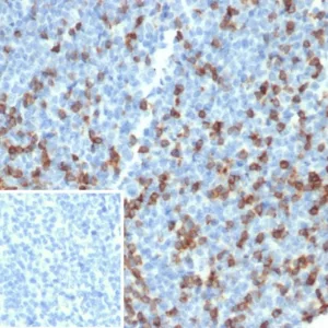 Formalin-fixed, paraffin-embedded human tonsil stained with PD1 (CD279) Recombinant Rabbit Monoclonal Antibody (PDCD1/4231R). Inset: PBS instead of primary antibody; secondary only negative control.