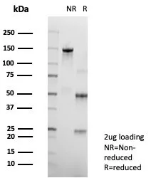 SDS-PAGE Analysis of Purified PDGFR-A Mouse Monoclonal Antibody (PDGFRA/7407). Confirmation of Purity and Integrity of Antibody.