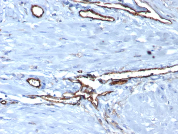 Formalin-fixed, paraffin-embedded human placenta stained with  CD31 Mouse Monoclonal Antibody (PECAM1/3539). HIER: Tris/EDTA, pH9.0, 45min. 2°C: HRP-polymer, 30min. DAB, 5min.