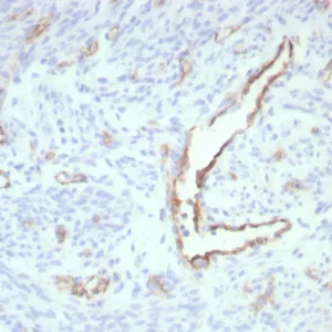 Formalin-fixed, paraffin-embedded human uterus stained with  CD31 Recombinant Mouse Monoclonal Antibody (rPECAM1/8826). HIER: Tris/EDTA, pH9.0, 45min. 2°C: HRP-polymer, 30min. DAB, 5min.