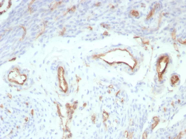 Formalin-fixed, paraffin-embedded human uterus stained with  CD31 Mouse Monoclonal Antibody (rPECAM1/8827). HIER: Tris/EDTA, pH9.0, 45min. 2°C: HRP-polymer, 30min. DAB, 5min.