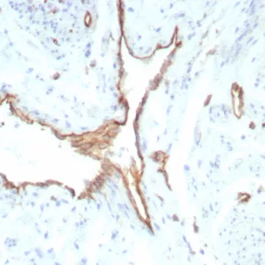 Formalin-fixed, paraffin-embedded human uterus stained with  CD31 Recombinant Mouse Monoclonal Antibody (rPECAM1/8829). HIER: Tris/EDTA, pH9.0, 45min. 2°C: HRP-polymer, 30min. DAB, 5min.
