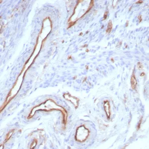 Formalin-fixed, paraffin-embedded human uterus stained with  CD31 Recombinant Mouse Monoclonal Antibody (rPECAM1/8830). HIER: Tris/EDTA, pH9.0, 45min. 2°C: HRP-polymer, 30min. DAB, 5min.