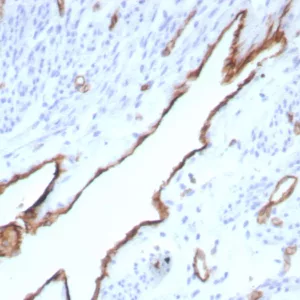 Formalin-fixed, paraffin-embedded human placenta stained with  CD31 Recombinant Mouse Monoclonal Antibody (rPECAM1/8832). HIER: Tris/EDTA, pH9.0, 45min. 2°C: HRP-polymer, 30min. DAB, 5min.