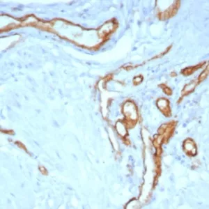 Formalin-fixed, paraffin-embedded human uterus stained with CD31 Rabbit Recombinant Monoclonal Antibody (C31/8243R). HIER: Tris/EDTA, pH9.0, 45min. 2°C: HRP-polymer, 30min. DAB, 5min.
